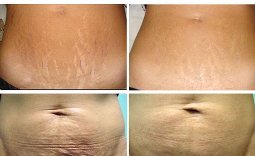 Fot. materiały prasowe