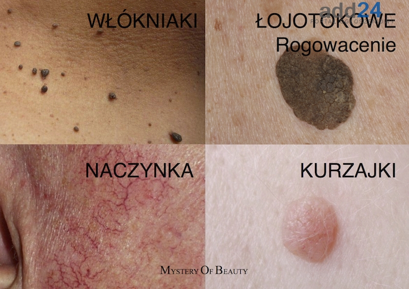 Fot. materiały promocyjne Magia SPA