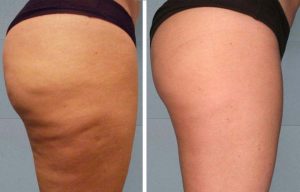 Fot. materiały promocyjne reklamodawcy