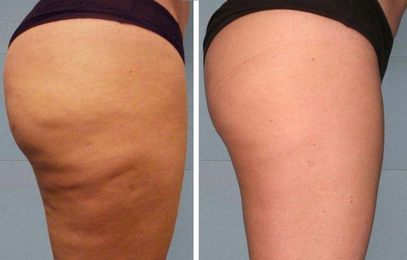 Fot. materiały promocyjne reklamodawcy