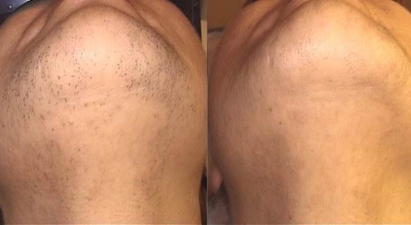 Fot. materiały promocyjne należące do reklamodawcy