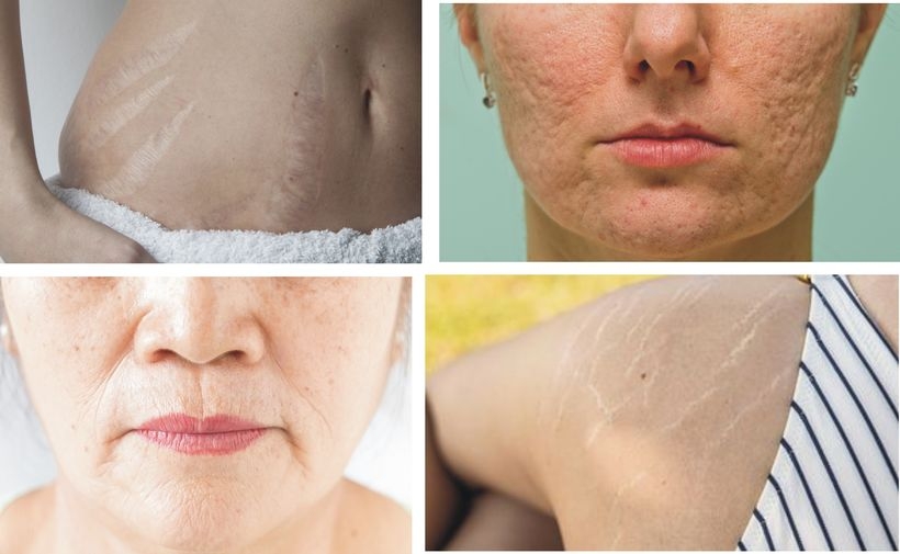 Fot. materiały promocyjne należące do reklamodawcy