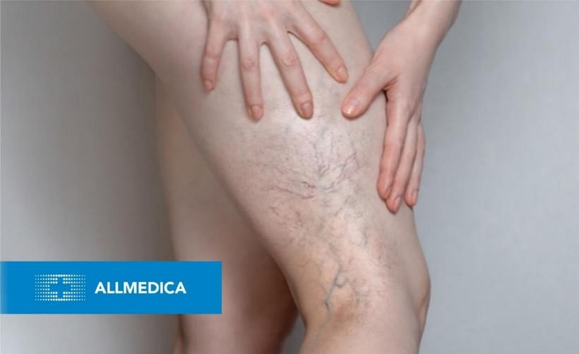 Fot. materiał prasowy reklamodawcy