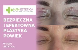 Fot. materiał prasowy reklamodawcy