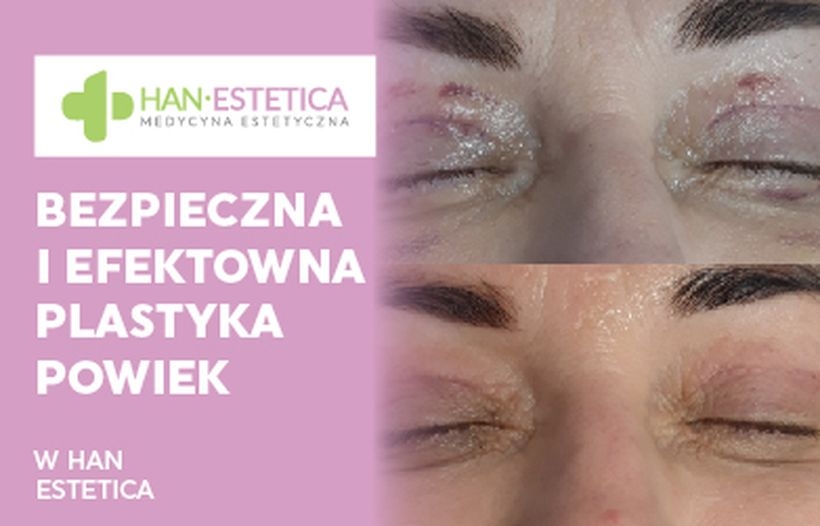 Fot. materiał prasowy reklamodawcy